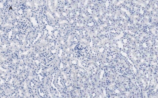 Anti-Calbindin D-28K clone 1A11 Antibody, ZooMAb<sup>®</sup> Rabbit Monoclonal