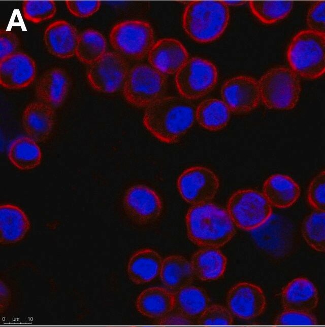 Anti-Adenovirus Hexon Antibody, clone 7/48.7c ZooMAb<sup>®</sup> Mouse Monoclonal