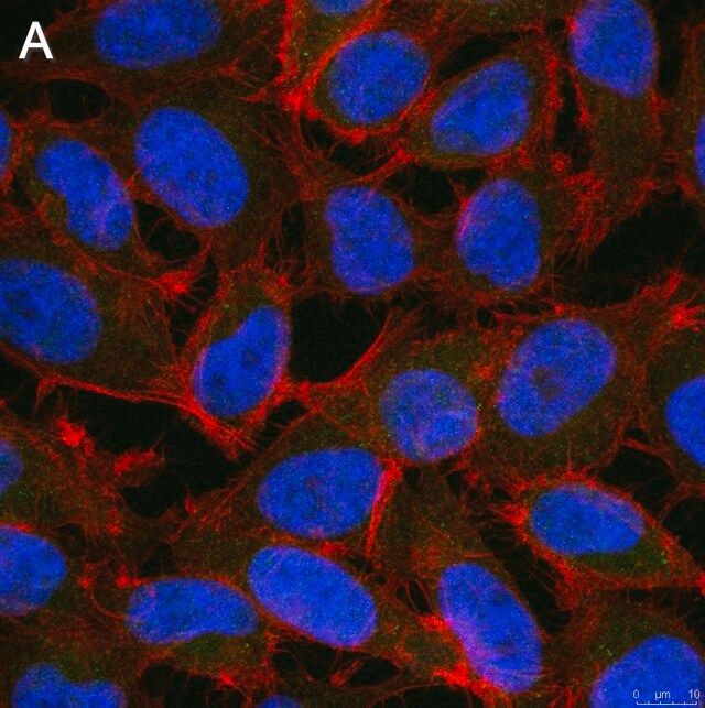 Anti-ALKBH5 Antibody, clone 6G7 ZooMAb<sup>®</sup> Rabbit Monoclonal