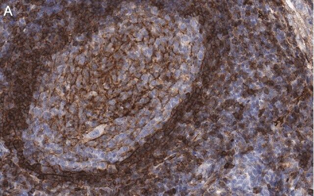 Anti-CD73 (NT5E) Antibody, clone 1F22 ZooMAb<sup>®</sup> Rabbit Monoclonal