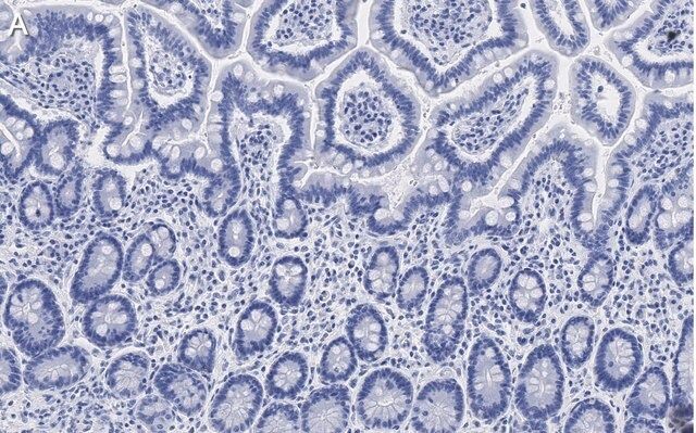 Anti-Gab1 Antibody, clone 4B20, ZooMAb<sup>®</sup> Rabbit Monoclonal
