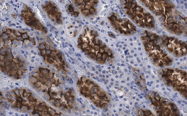 Anti-Ezrin Antibody, clone 1D15 ZooMAb<sup>®</sup> Rabbit Monoclonal