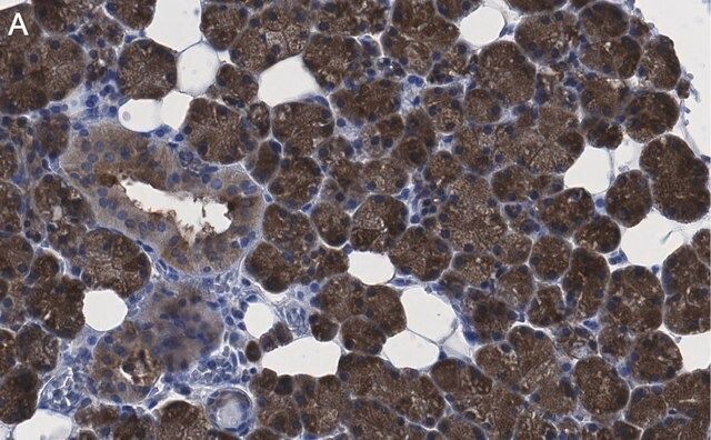 Anti-ATG9A Antibody, clone 5B11, ZooMAb<sup>®</sup> Rabbit Monoclonal