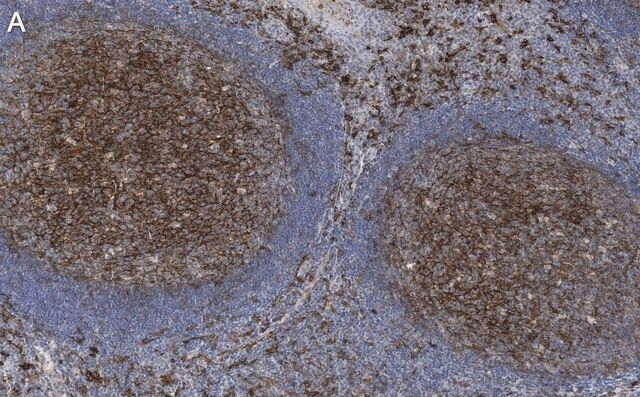 Anti-CD14 Antibody, clone 1B4 ZooMAb<sup>®</sup> Rabbit Monoclonal