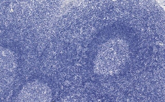 Anti-CD3e Antibody, clone 1H4, ZooMAb<sup>®</sup> Rabbit Monoclonal