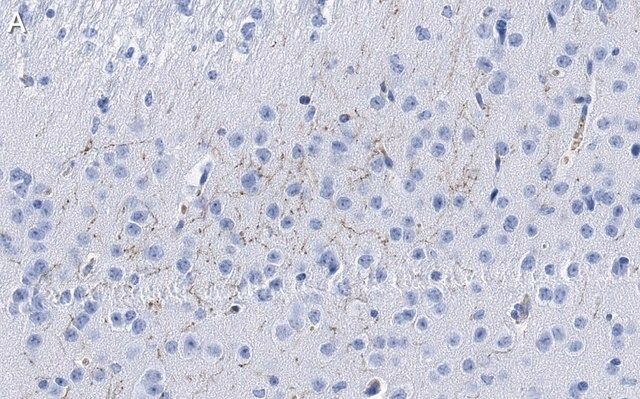 Anti-Dopamine Transporter Antibody, clone 1D2 ZooMAb<sup>®</sup> Rabbit Monoclonal
