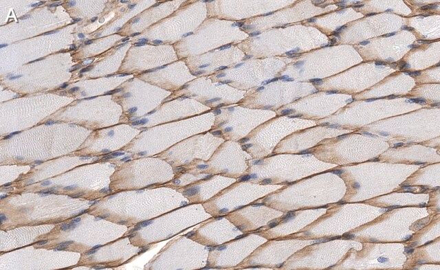Anti-Dystrophin Antibody, clone 1G7, ZooMAb<sup>®</sup> Rabbit Monoclonal