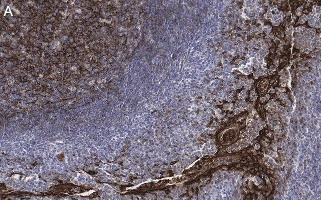 Anti-Clusterin Antibody, clone 2F23 ZooMAb<sup>®</sup> Rabbit Monoclonal