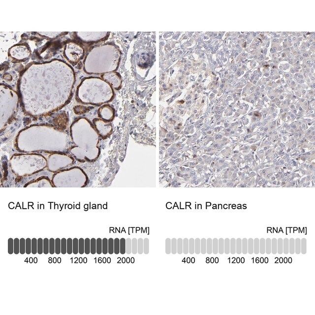 Anti-CALR antibody produced in rabbit