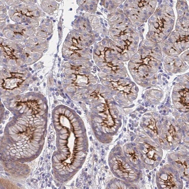 Anti-SSTR1 antibody produced in rabbit