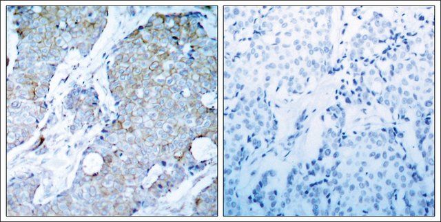 Anti-KDR (Ab-1214) antibody produced in rabbit