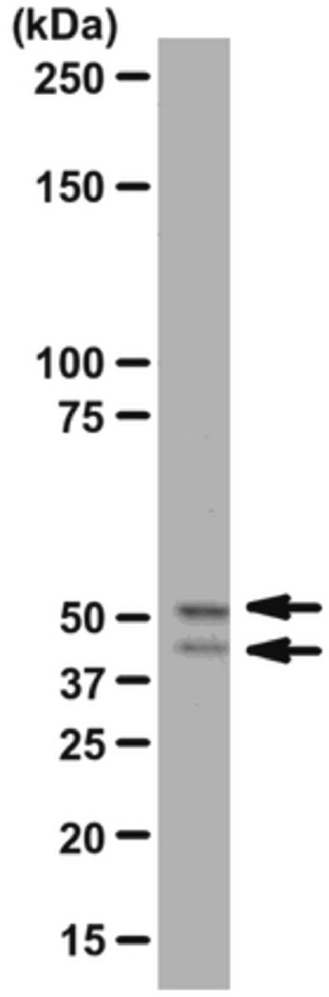 Anti-GSK3α/β Antibody, rabbit monoclonal