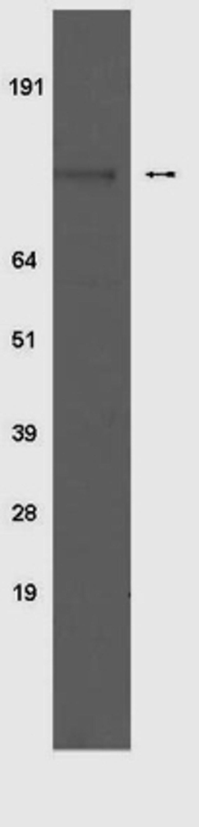 Anti-phospho-Insulin Receptor (Tyr 1150/1151) Antibody, clone 10C3