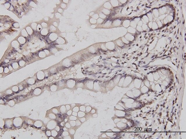 Monoclonal Anti-GABPA antibody produced in mouse