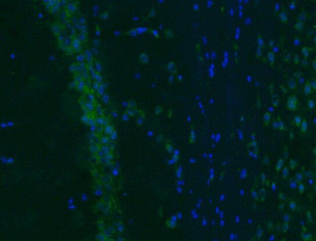 Anti-Vesicular Glutamate Transporter 2 Antibody, Alexa Fluor<sup>®</sup> 488 | MAB5504A4