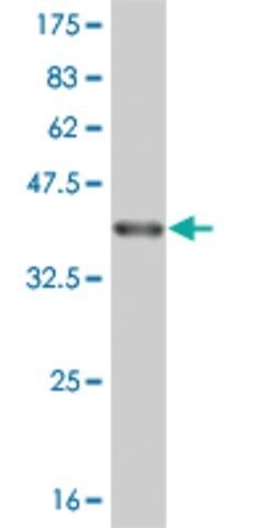 Monoclonal Anti-CTAG2 antibody produced in mouse