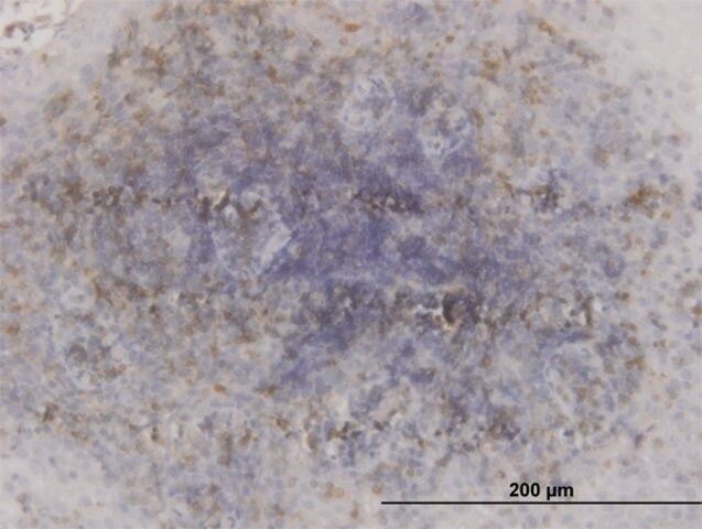 Monoclonal Anti-GSK3B antibody produced in mouse