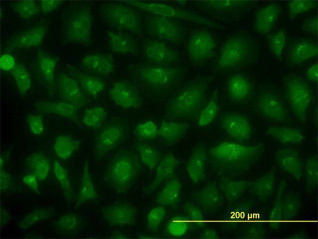 Monoclonal Anti-KIAA1967 antibody produced in mouse