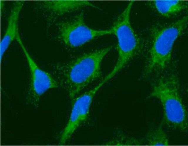 Anti-Glucose Regulating Protein 94 (GRP94) Antibody