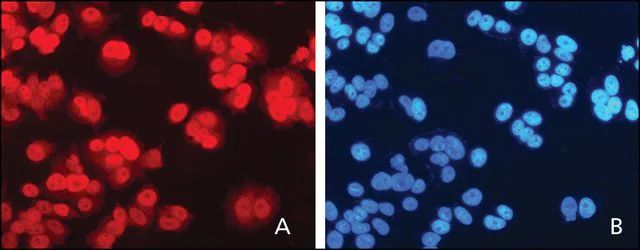 Anti-XPC (C-terminal) antibody produced in rabbit