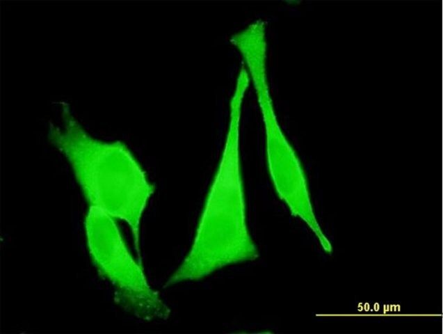 Monoclonal Anti-FZD3 antibody produced in mouse