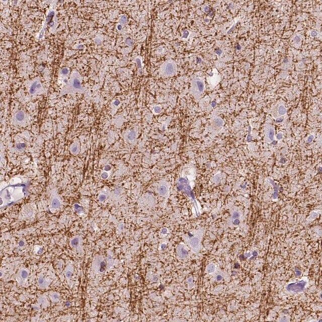 Anti-Sirt2 antibody produced in rabbit