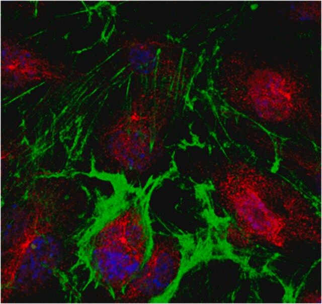 Anti-PPAR-gamma Antibody