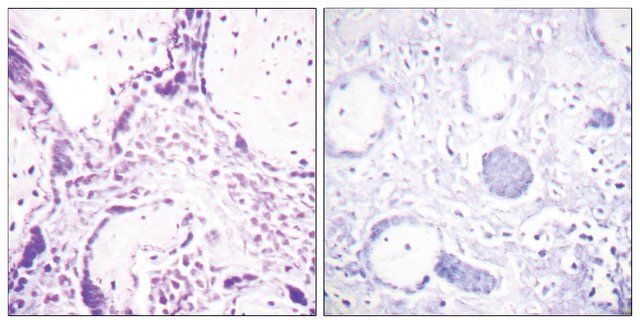 Anti-PPAR-γ antibody produced in rabbit