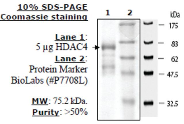 HDAC-4 human