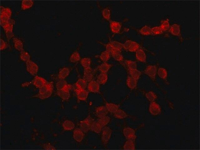 Anti-E-Selectin (CD62E) antibody, Mouse monoclonal