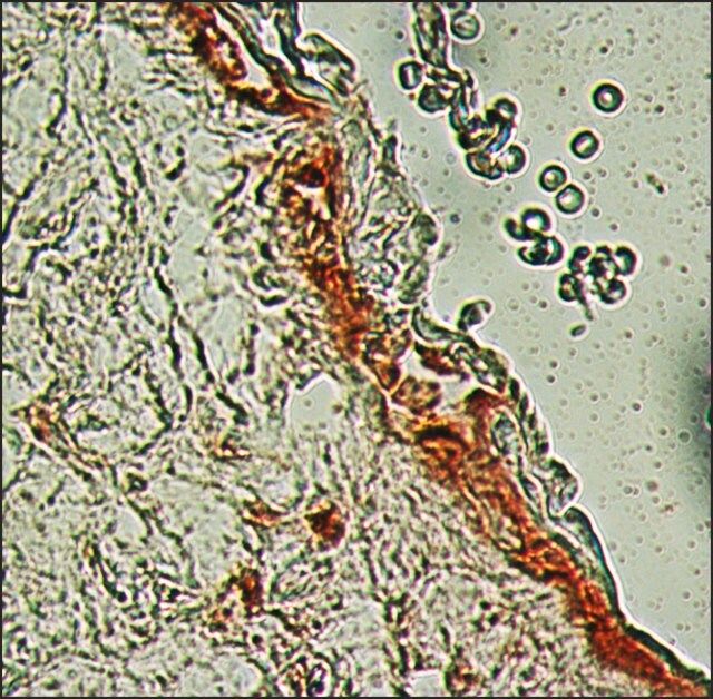Anti-Fibroblast Growth Factor Receptor-3, Extracellular antibody produced in rabbit