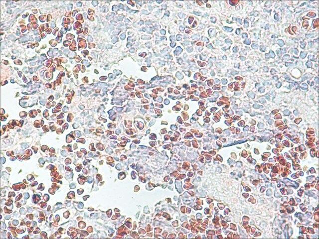 Anti-Histone Deacetylase 2 (HDAC2) antibody produced in rabbit