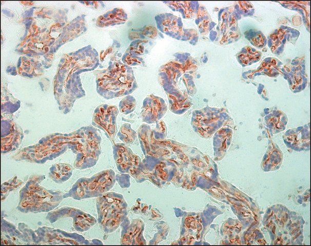 Monoclonal Anti-Vascular Endothelial Growth Factor Receptor-2 antibody produced in mouse