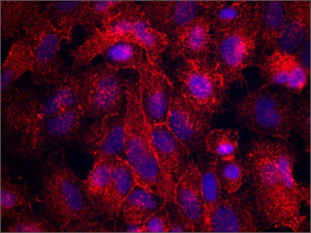 Monoclonal Anti-Moesin antibody produced in mouse