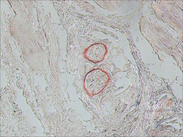 Monoclonal Anti-Nerve Growth Factor Receptor (NGFR p75) antibody produced in mouse