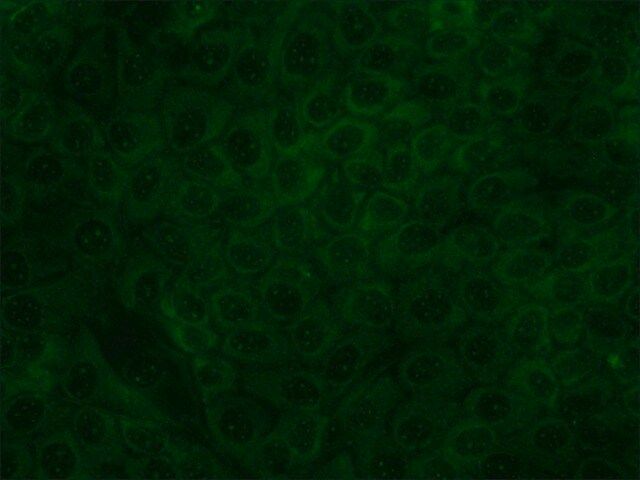 Monoclonal Anti-p120<sup>ctn</sup> (Catenin-related) antibody produced in mouse