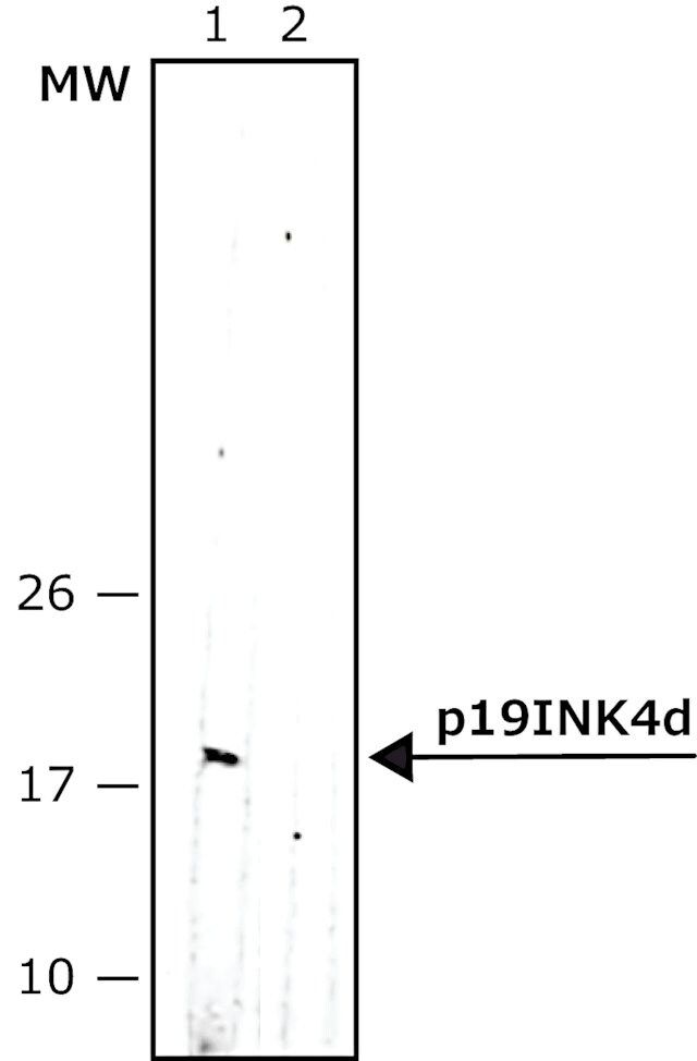 Monoclonal Anti-p19<sup>INK4d</sup> antibody produced in mouse