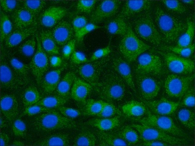 Monoclonal Anti-S100A2 antibody produced in mouse