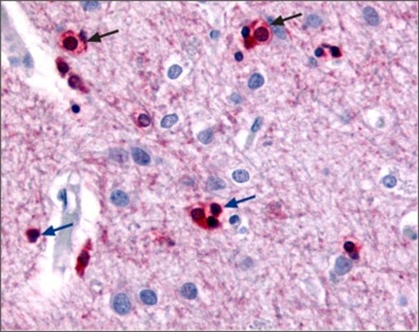 Anti-Potassium Channel SK2 antibody produced in rabbit