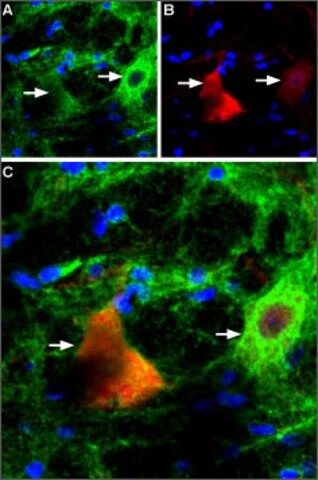 Anti-P2X<sub>4</sub> Purinergic Receptor antibody produced in rabbit