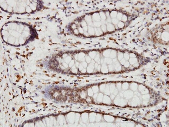 Monoclonal Anti-WDR20 antibody produced in mouse