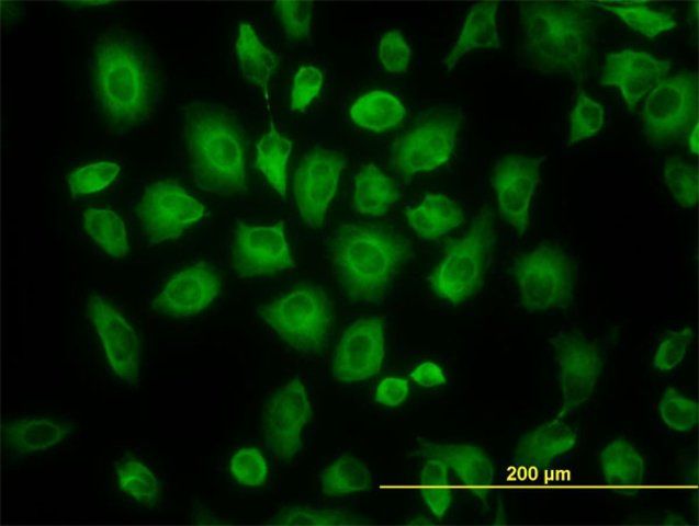 Monoclonal Anti-TUBB2C antibody produced in mouse