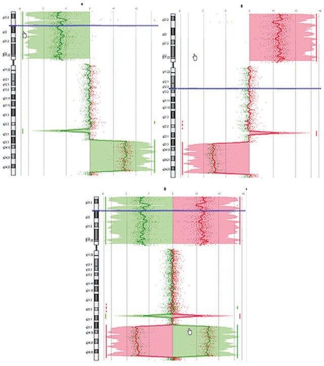 GenomePlex<sup>®</sup> Complete Whole Genome Amplification (WGA) Kit