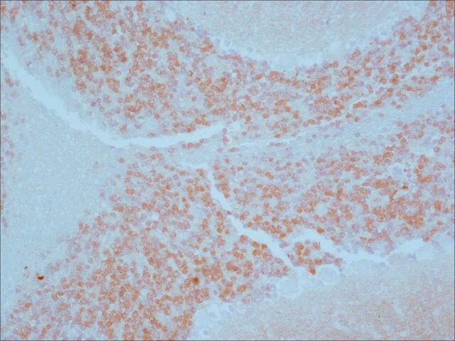 Anti-Calretinin antibody produced in rabbit