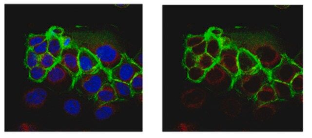 Anti-Epithelial Specific Antigen Antibody, clone VU-1D9