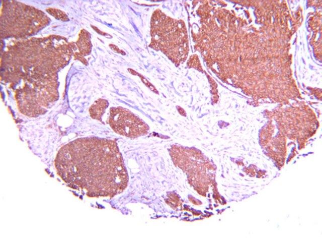 Anti-Hypoxia Inducible Factor 1 α Antibody, clone H1α67