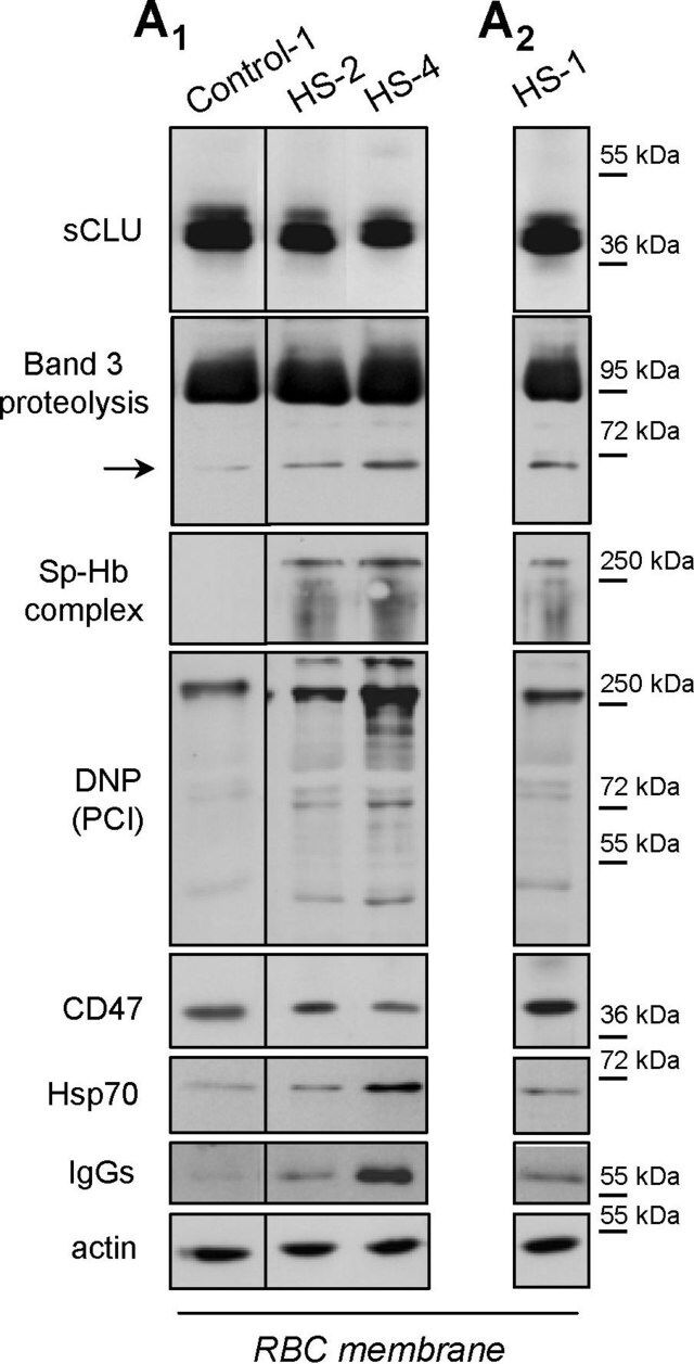 Anti-Human IgG (whole molecule)-Peroxidase antibody produced in rabbit