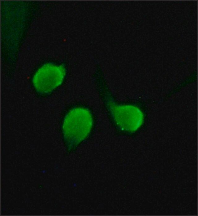 Anti-Histone Deacetylase 4 (HDAC4) (ML-19) antibody produced in rabbit
