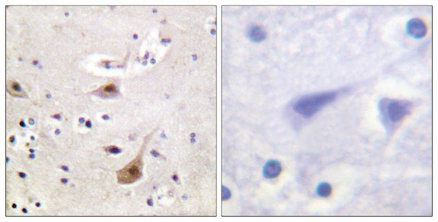 Anti-Androgen Receptor, N-Terminal antibody produced in rabbit