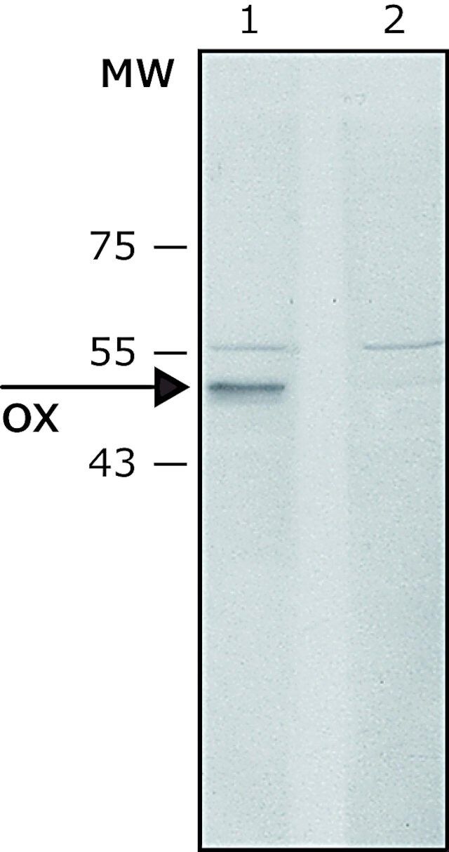 Anti-Lysyl Oxidase (C-terminal) antibody produced in rabbit